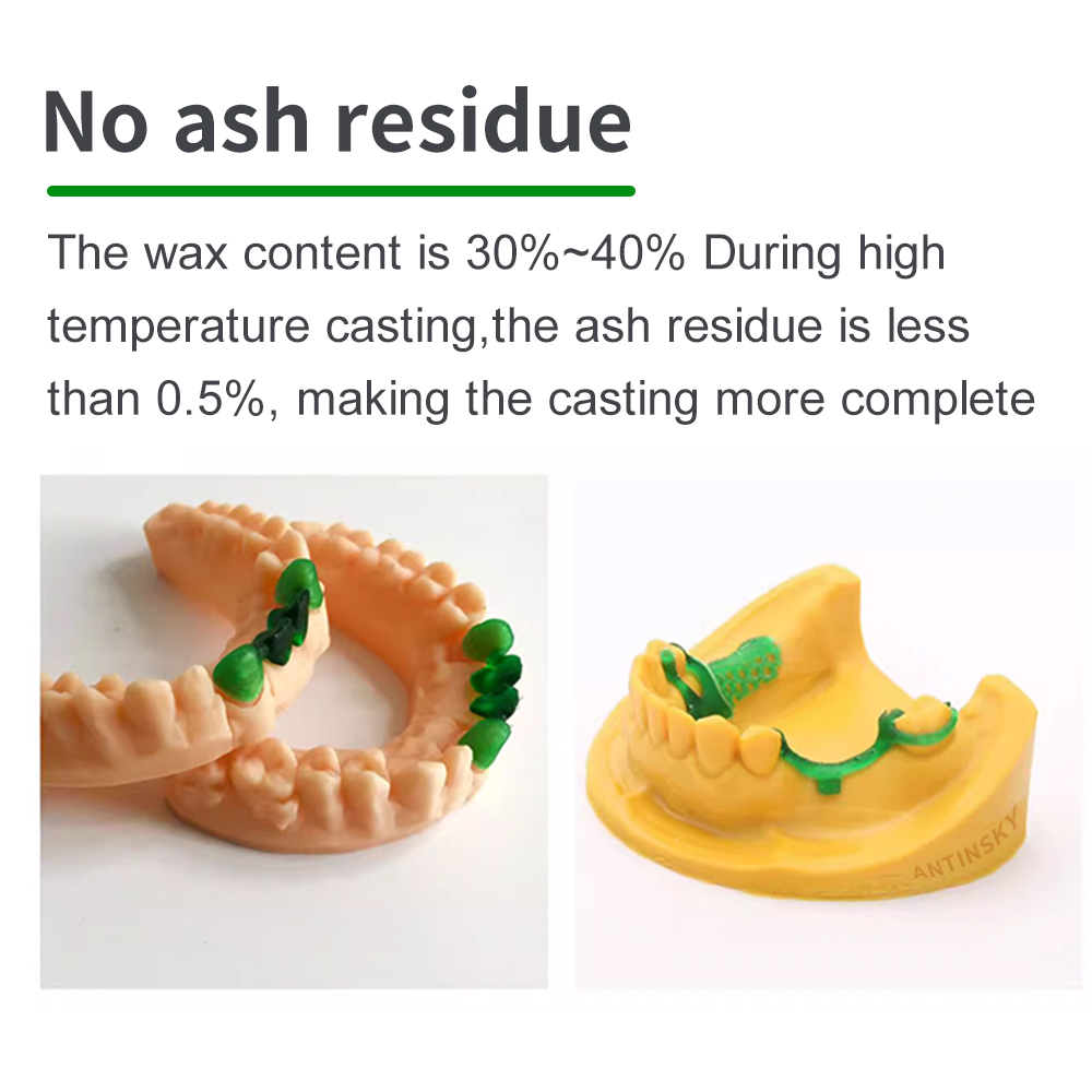 Antinsky Castable Dental Smart - огляд і ціна 3D Printing Sla